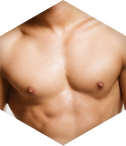 imag_for_treatment15 חזה של גבר אחרי הקטנת חזה