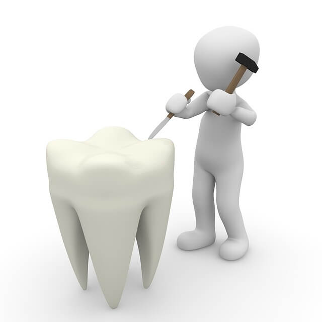 השתלת שיניים ביום אחד- ניתוח אסתטי בלבד או משפר איכות חיים?